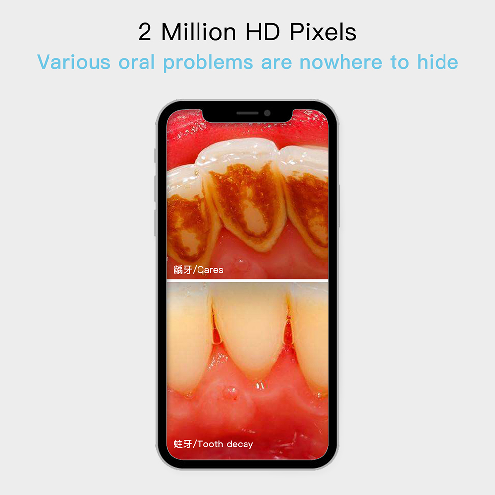 מצלמת שיניים ב-HD Full HD